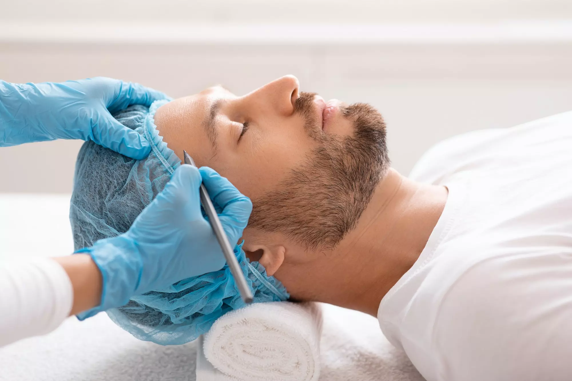 handsome-man-getting-pencil-marks-on-forehead-before-surgery.jpg